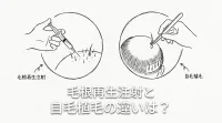 毛根再生注射と自毛植毛の違いは？