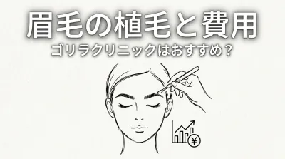 眉毛の植毛や費用はゴリラクリニックがおすすめ？
