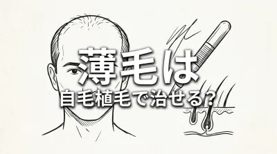薄毛は自毛植毛で治せる？