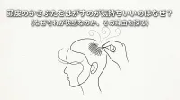 頭皮のかさぶたをはがすのが気持ちいいのはなぜ？