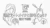 頭皮アートメイクと植毛どっち？論文で検証