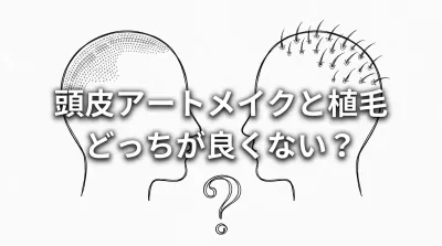 頭皮アートメイクと植毛どっちが良くない？