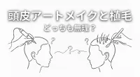 頭皮アートメイクと植毛どっちも無理？