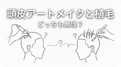 頭皮アートメイクと植毛どっちも無理？