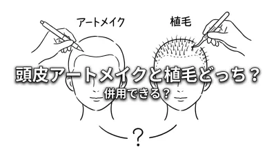 頭皮アートメイクと植毛どっち？併用できる？