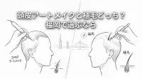 頭皮アートメイクと植毛どっち?福岡で選ぶなら