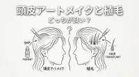 頭皮アートメイクと植毛どっちが良い？