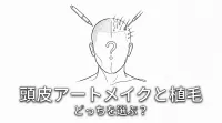 頭皮アートメイクと植毛どっちを選ぶ？
