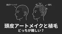 頭皮アートメイクと植毛どっちが難しい?