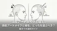 頭皮アートメイクと植毛、どっちを選ぶべき？東京での選択ガイド
