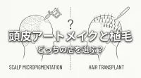頭皮アートメイクと植毛どっちの店を選ぶ？