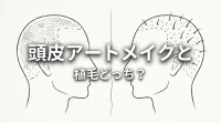 頭皮アートメイクと植毛どっち？