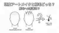 頭皮アートメイクと植毛どっち？脱毛への影響は？