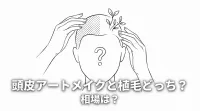 頭皮アートメイクと植毛どっち？相場は？