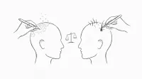 頭皮のアートメイクと植毛どっちがいい？ザラザラするって本当？