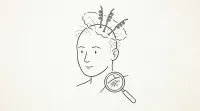 人工毛植毛のデメリットとは？