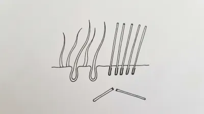 人工毛植毛のデメリットまとめ|なぜ推奨されない？
